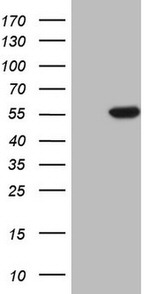 CDKL2 Antibody in Western Blot (WB)