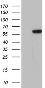 CDKL2 Antibody in Western Blot (WB)