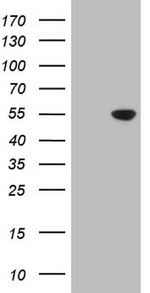 CDKL2 Antibody in Western Blot (WB)
