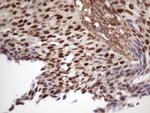 CDKN1A Antibody in Immunohistochemistry (Paraffin) (IHC (P))