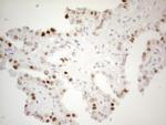 CDKN1A Antibody in Immunohistochemistry (Paraffin) (IHC (P))