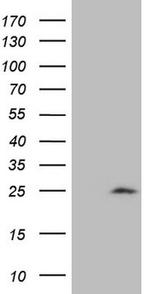 CDKN1A Antibody in Western Blot (WB)