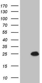 CDKN1A Antibody in Western Blot (WB)
