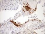 CDKN2A Antibody in Immunohistochemistry (Paraffin) (IHC (P))