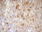 CDKN2A Antibody in Immunohistochemistry (Paraffin) (IHC (P))