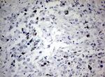 CDKN2A Antibody in Immunohistochemistry (Paraffin) (IHC (P))