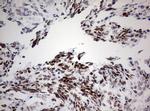 CDKN2A Antibody in Immunohistochemistry (Paraffin) (IHC (P))