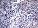 CDKN2A Antibody in Immunohistochemistry (Paraffin) (IHC (P))