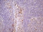 CDKN2A Antibody in Immunohistochemistry (Paraffin) (IHC (P))