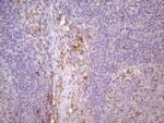 CDKN2A Antibody in Immunohistochemistry (Paraffin) (IHC (P))