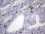 CDKN2A Antibody in Immunohistochemistry (Paraffin) (IHC (P))