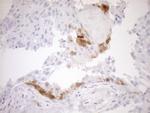 CDKN2A Antibody in Immunohistochemistry (Paraffin) (IHC (P))