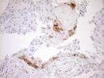 CDKN2A Antibody in Immunohistochemistry (Paraffin) (IHC (P))