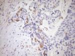 CDKN2A Antibody in Immunohistochemistry (Paraffin) (IHC (P))