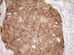 CDKN2A Antibody in Immunohistochemistry (Paraffin) (IHC (P))