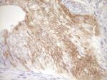 CDKN2A Antibody in Immunohistochemistry (Paraffin) (IHC (P))
