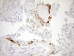 CDKN2A Antibody in Immunohistochemistry (Paraffin) (IHC (P))