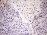 CDKN2A Antibody in Immunohistochemistry (Paraffin) (IHC (P))
