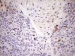 CDKN2A Antibody in Immunohistochemistry (Paraffin) (IHC (P))