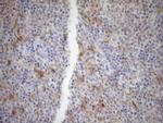CDKN2A Antibody in Immunohistochemistry (Paraffin) (IHC (P))