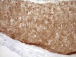 CDKN2A Antibody in Immunohistochemistry (Paraffin) (IHC (P))