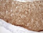 CDKN2A Antibody in Immunohistochemistry (Paraffin) (IHC (P))