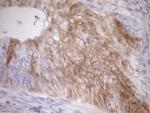 CDKN2A Antibody in Immunohistochemistry (Paraffin) (IHC (P))