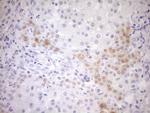 CDKN2A Antibody in Immunohistochemistry (Paraffin) (IHC (P))