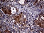 CDKN2A Antibody in Immunohistochemistry (Paraffin) (IHC (P))