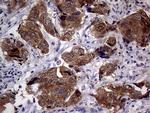 CDKN2A Antibody in Immunohistochemistry (Paraffin) (IHC (P))