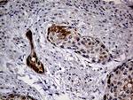 CDKN2A Antibody in Immunohistochemistry (Paraffin) (IHC (P))