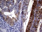 CDKN2A Antibody in Immunohistochemistry (Paraffin) (IHC (P))