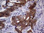 CDKN2A Antibody in Immunohistochemistry (Paraffin) (IHC (P))