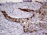 CDKN2A Antibody in Immunohistochemistry (Paraffin) (IHC (P))
