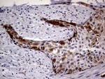 CDKN2A Antibody in Immunohistochemistry (Paraffin) (IHC (P))
