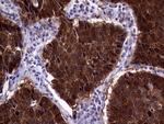 CDKN2A Antibody in Immunohistochemistry (Paraffin) (IHC (P))