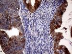 CDKN2A Antibody in Immunohistochemistry (Paraffin) (IHC (P))