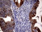 CDKN2A Antibody in Immunohistochemistry (Paraffin) (IHC (P))