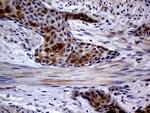 CDKN2A Antibody in Immunohistochemistry (Paraffin) (IHC (P))