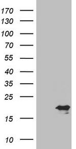 CDKN2A Antibody in Western Blot (WB)