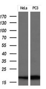 CDKN2A Antibody in Western Blot (WB)
