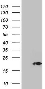 CDKN2A Antibody in Western Blot (WB)
