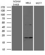 CDKN2A Antibody in Western Blot (WB)