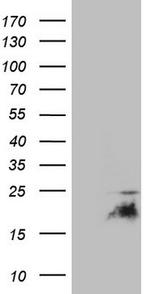 CDKN2A Antibody in Western Blot (WB)