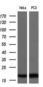 CDKN2A (p16INK4a) Antibody in Western Blot (WB)