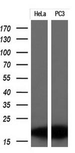 CDKN2A (p16INK4a) Antibody in Western Blot (WB)