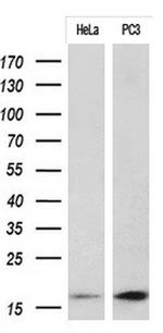 CDKN2A Antibody in Western Blot (WB)