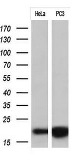 CDKN2A (p16INK4a) Antibody in Western Blot (WB)
