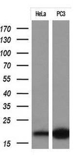 CDKN2A Antibody in Western Blot (WB)