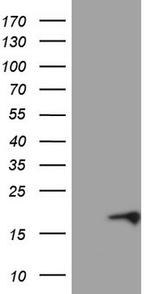 CDKN2A (p16INK4a) Antibody in Western Blot (WB)